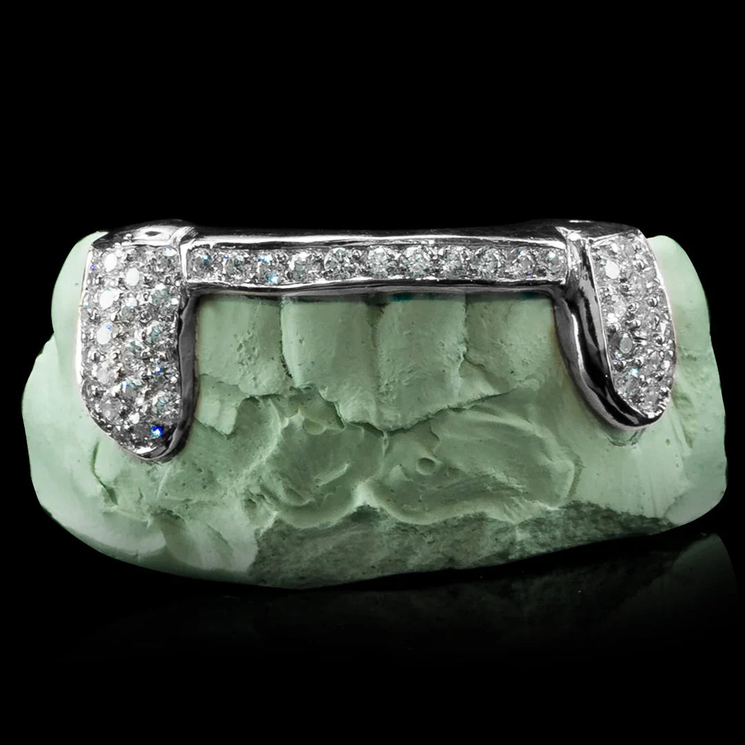 Custom grillz by Alijah The Jeweler