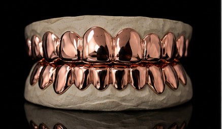 Gold Grillz