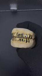 Custom solid gold grillz on dental mold