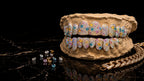 Iced multi-color stone grillz design